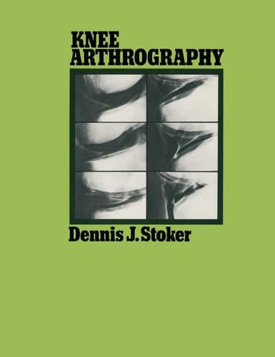 Knee Arthrography