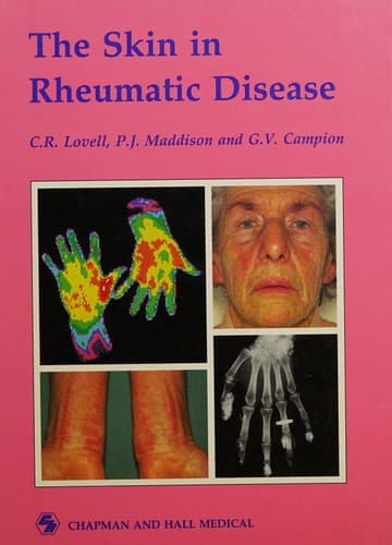 The Skin in Rheumatic Disease