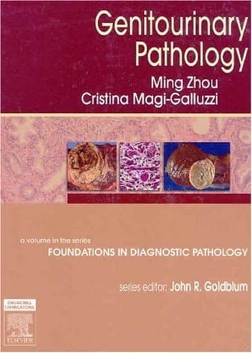 Genitourinary Pathology: A Volume in Foundations in Diagnostic Pathology Series