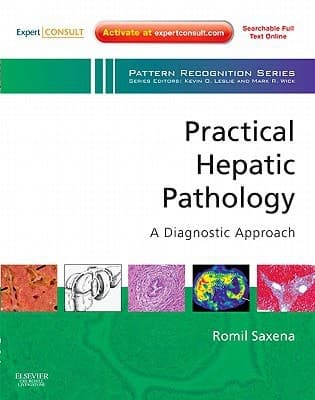 Practical Hepatic Pathology A Diagnostic Approach