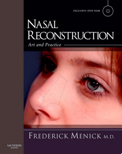 Nasal Reconstruction Art and Practice