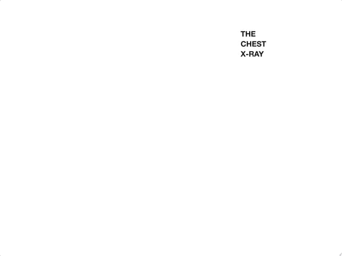 The Chest X-Ray: A Survival Guide