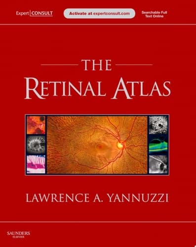 The Retinal Atlas