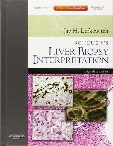 Scheuer's Liver Biopsy Interpretation