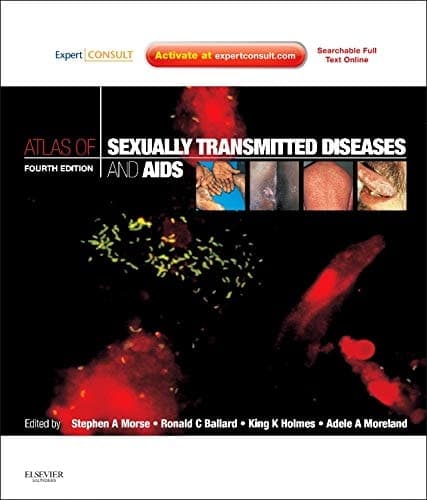 Atlas of Sexually Transmitted Diseases and AIDS