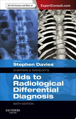 Chapman & Nakielny's Aids to Radiological Differential Diagnosis Expert Consult - Online and Print