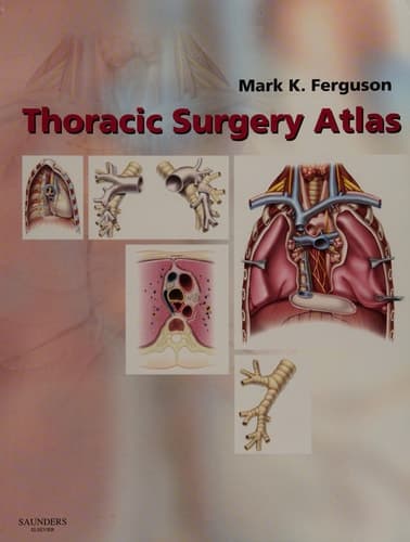 Thoracic Surgery Atlas