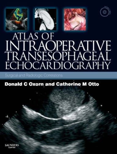 Atlas of Intraoperative Transesophageal Echocardiography: Surgical and Radiologic Correlations, Text with DVD