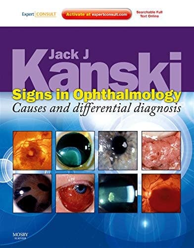 Signs in Ophthalmology Causes and Differential Diagnosis