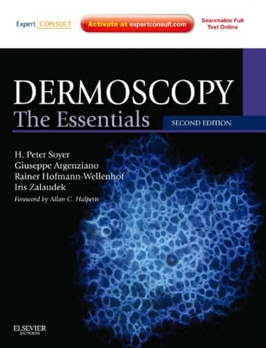 Dermoscopy The Essentials