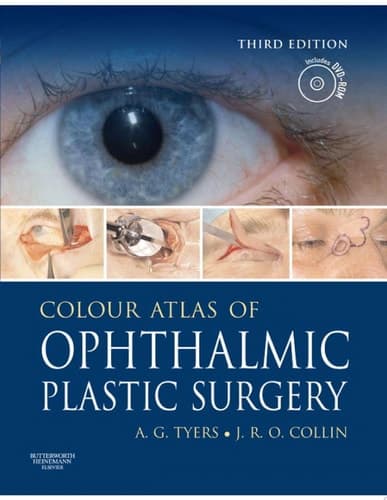 Colour Atlas of Ophthalmic Plastic Surgery