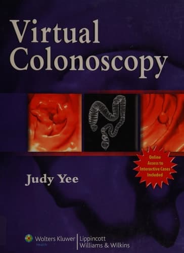 Virtual Colonoscopy