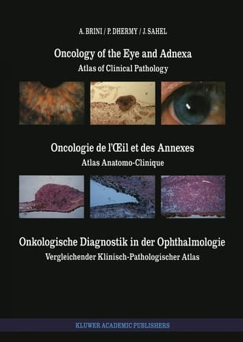 Oncology of the Eye and Adnexa / Oncologie de l’Œil et des Annexes / Onkologische Diagnostik in der Ophthalmologie: Atlas of Clinical Pathology / ... (English, French and German Edition)