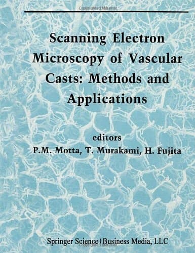 Scanning Electron Microscopy of Vascular Casts: Methods and Applications (Electron Microscopy in Biology and Medicine)