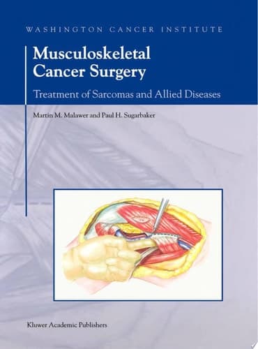 Musculoskeletal Cancer Surgery Treatment of Sarcomas and Allied Diseases