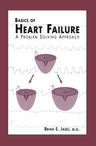 Basics of Heart Failure A Problem Solving Approach