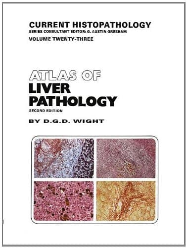 Atlas of Liver Pathology (Current Histopathology)