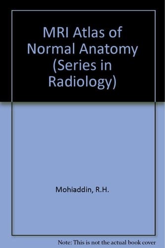 Atlas of Normal Anatomy MRI (Series in Radiology)