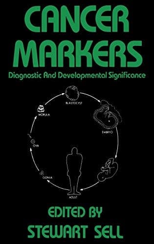 Cancer Markers: Diagnostic and Developmental Significance (Contemporary Biomedicine, 1)