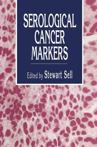 Serological Cancer Markers (Contemporary Biomedicine, 11)
