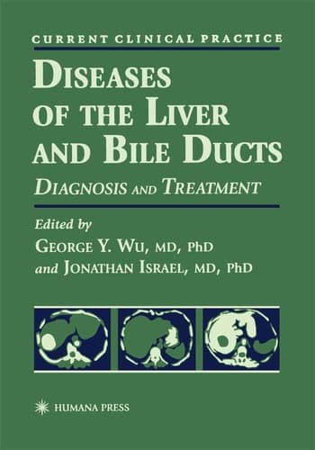 Diseases of the liver and bile ducts