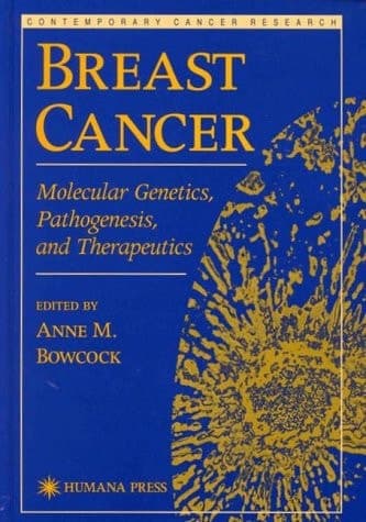 Breast Cancer: Molecular Genetics, Pathogenesis, and Therapeutics (Contemporary Cancer Research)
