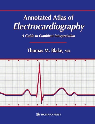 Annotated Atlas of Electrocardiography A Guide to Confident Interpretation