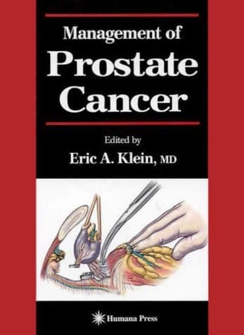 Management of Prostate Cancer