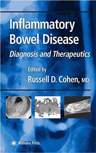 Inflammatory Bowel Disease: Diagnosis and Therapeutics (Clinical Gastroenterology)