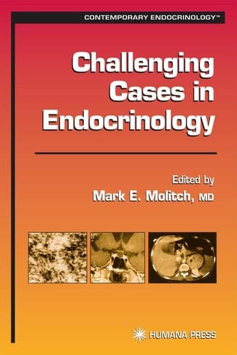 Challenging Cases in Endocrinology (Contemporary Endocrinology)