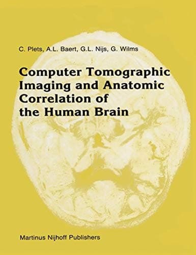 Computer Tomographic Imaging and Anatomic Correlation of the Human Brain: A comparative atlas of thin CT-scan sections and correlated neuro-anatomic preparations (Series in Radiology)