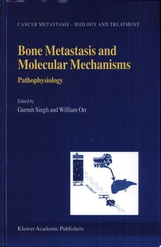 Bone Metastasis and Molecular Mechanisms Pathophysiology