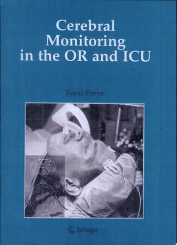 Cerebral Monitoring in the OR and ICU
