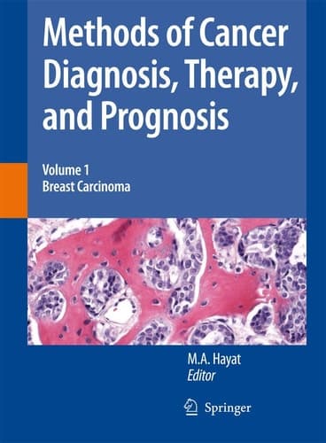 Methods of Cancer Diagnosis, Therapy and Prognosis Breast Carcinoma