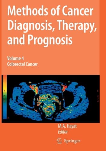 Methods of Cancer Diagnosis, Therapy and Prognosis Colorectal Cancer