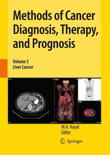 Methods of Cancer Diagnosis, Therapy, and Prognosis: Liver Cancer (Methods of Cancer Diagnosis, Therapy and Prognosis, 5)
