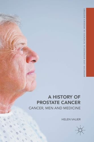 A History of Prostate Cancer: Cancer, Men and Medicine (Medicine and Biomedical Sciences in Modern History)