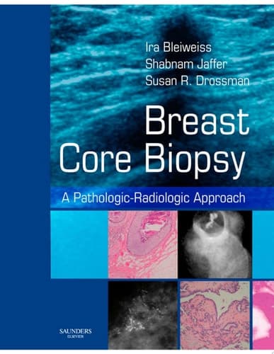Breast Core Biopsy A Pathologic-radiologic Correlative Approach