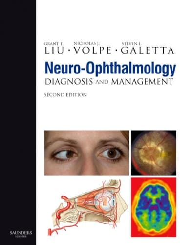 Neuro-ophthalmology Diagnosis and Management