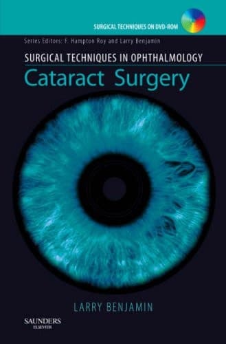 Cataract Surgery
