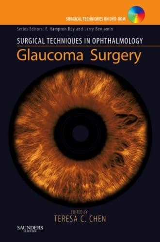 Glaucoma Surgery