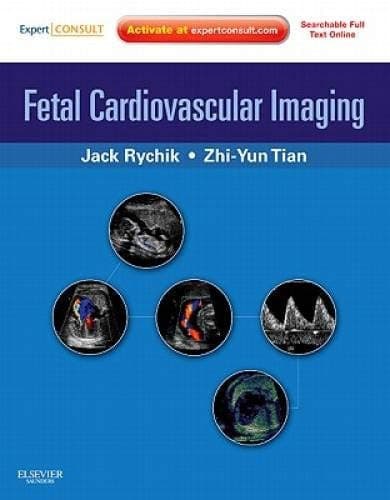 Fetal Cardiovascular Imaging A Disease-based Approach