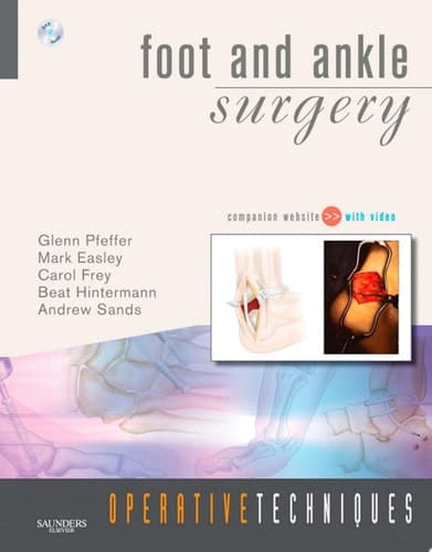 Foot and Ankle Surgery