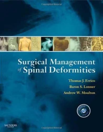 Surgical Management of Spinal Deformities