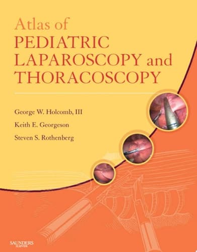 Atlas of Pediatric Laparoscopy and Thoracoscopy