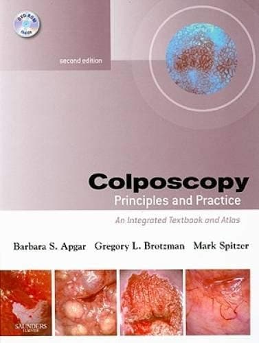 Colposcopy, Principles and Practice An Integrated Textbook and Atlas