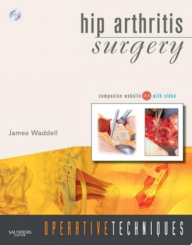 Hip Arthritis Surgery