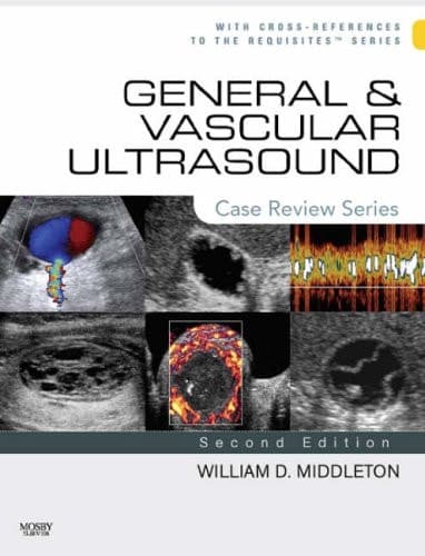 General and Vascular Ultrasound: Case Review Series