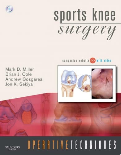 Sports Knee Surgery