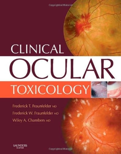 Clinical Ocular Toxicology Drugs, Chemicals, and Herbs